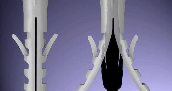 Corrupção não tem lado